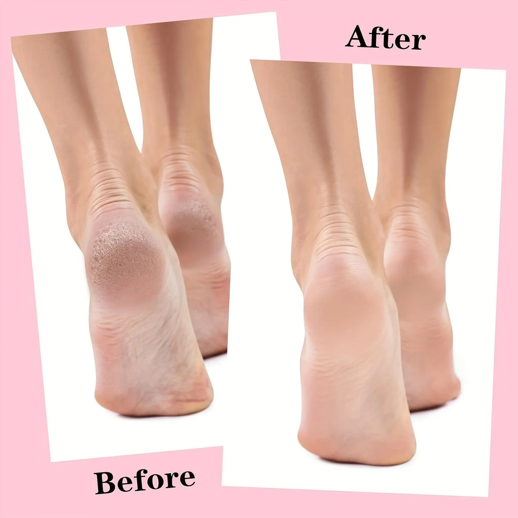 Silicone Gel Socks – Silicone Gel 1 Pair - Image 10