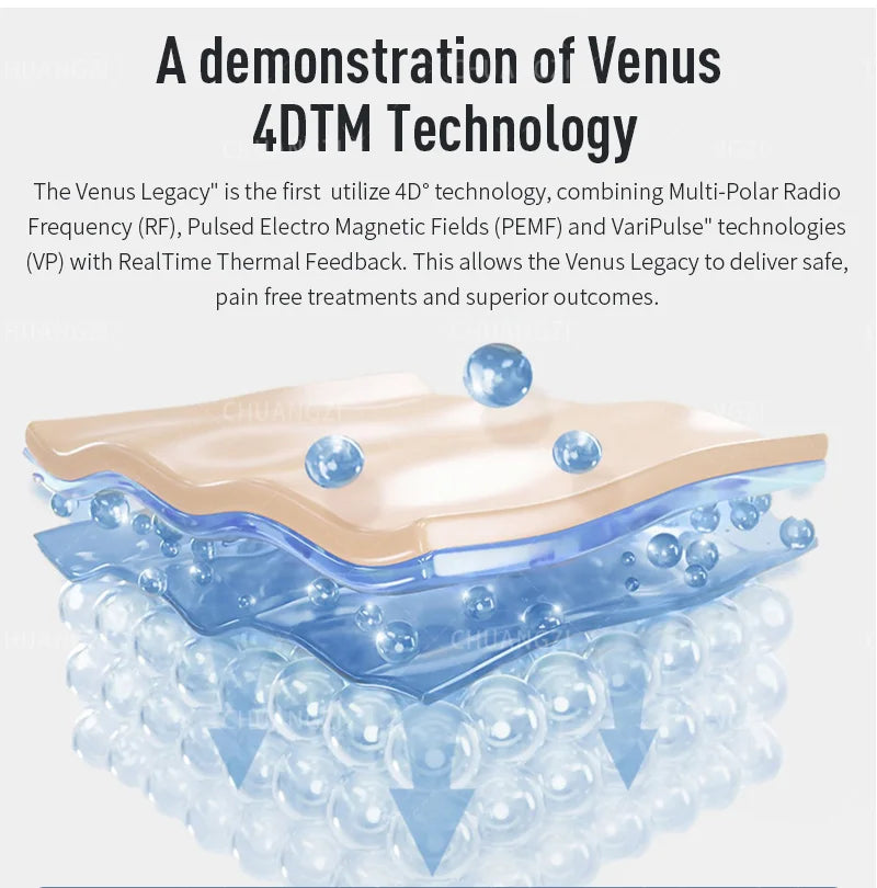 Actimel Venus Legacy skin tightening machine for salon, a professional beauty device with sleek design and control panel.